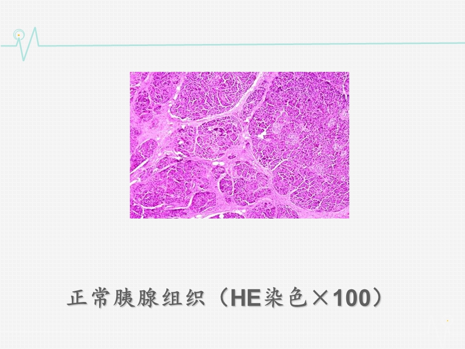 胰腺疾病 课件.ppt_第3页