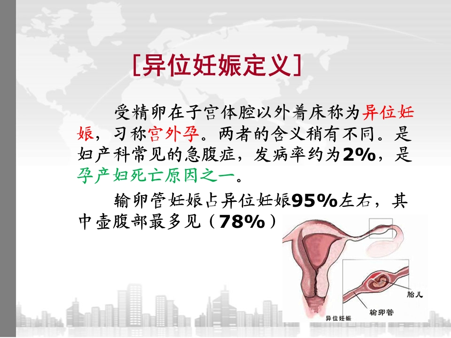 异位妊娠病人护理查房课件.ppt_第2页