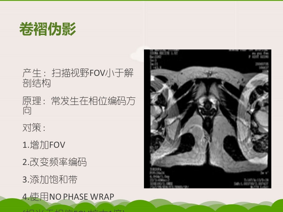 常见MR伪影及对策课件.ppt_第2页