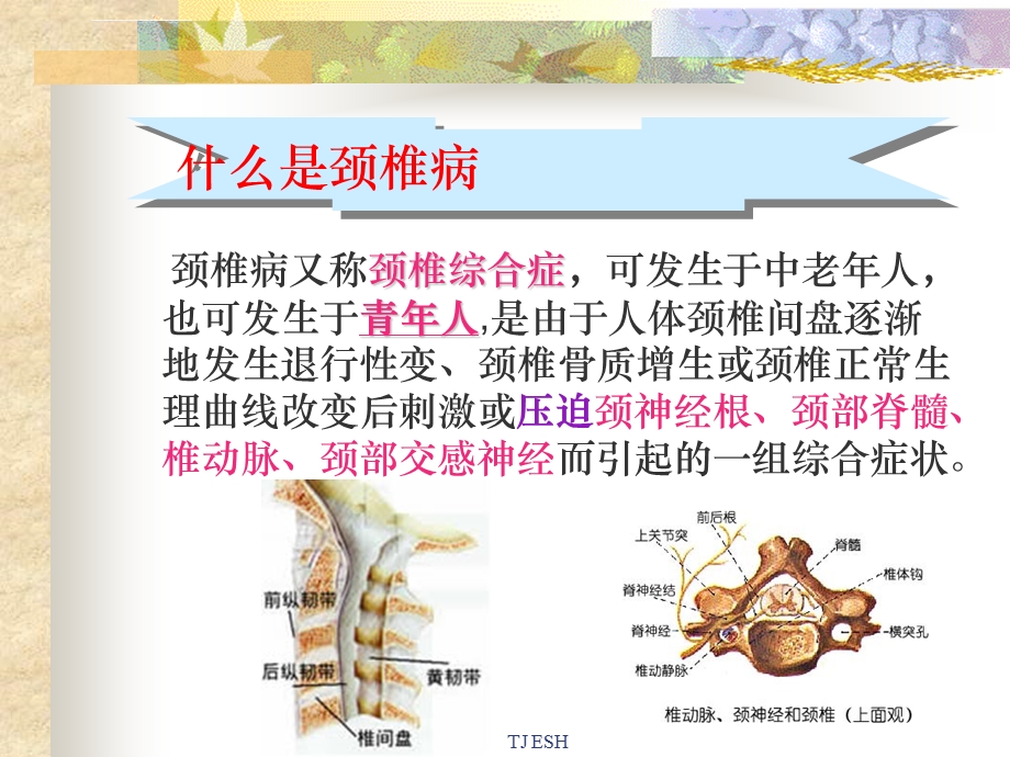 如何预防颈椎病课件.ppt_第2页