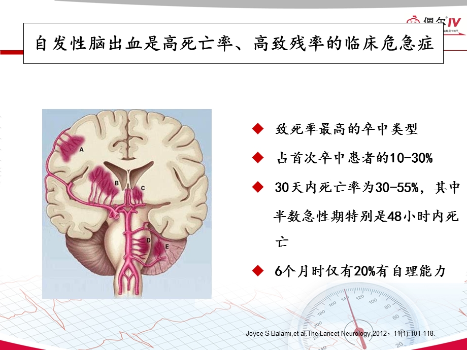 神经重症患者ICH血压管理指南解读课件.ppt_第1页