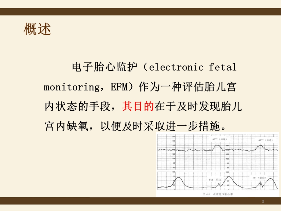 电子胎心监护应用专家共识课件.ppt_第3页