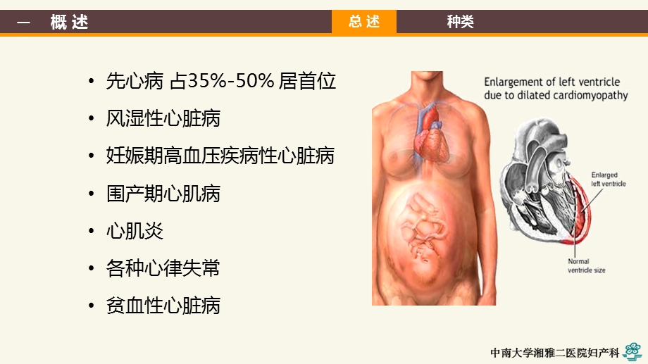 妊娠合并心脏病PPT课件.ppt_第3页