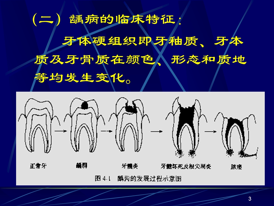 牙体牙髓病课件.ppt_第3页