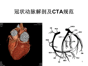 冠状动脉解剖与规范课件.ppt