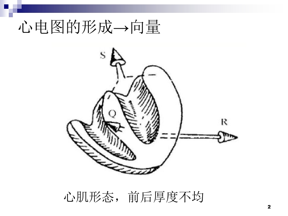 初学室性心动过速课件.ppt_第2页