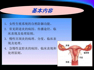 女性生殖系统炎症护理课件.ppt