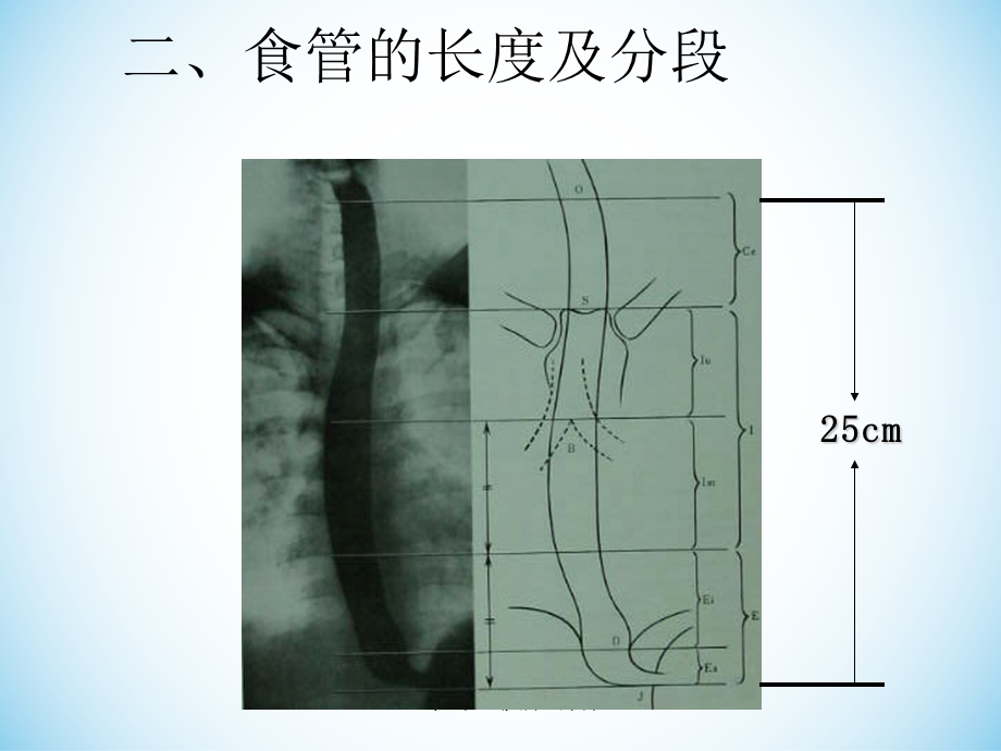 食管的常见疾病及其护理课件.ppt_第3页