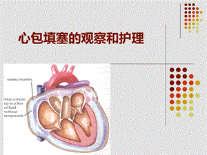 心包填塞的观察和护理 课件.ppt