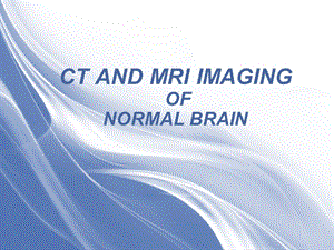 医学影像 正常颅脑CT和MRI影像表课件.ppt
