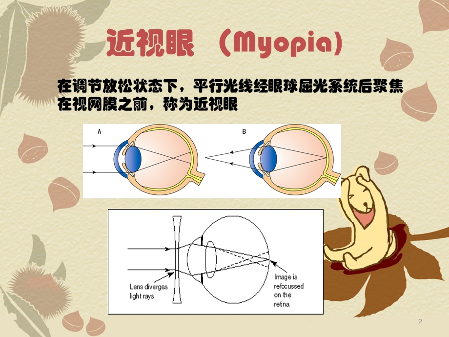 准分子激光课件.ppt_第2页