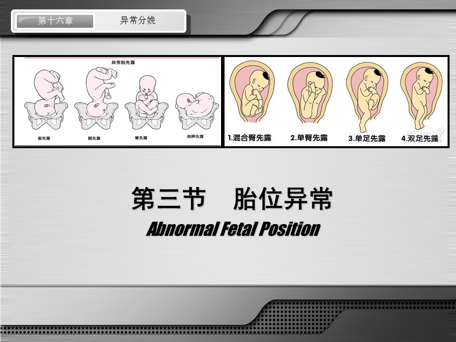 第八版妇产科配套ppt课件 异常分娩 胎位异常.ppt_第1页