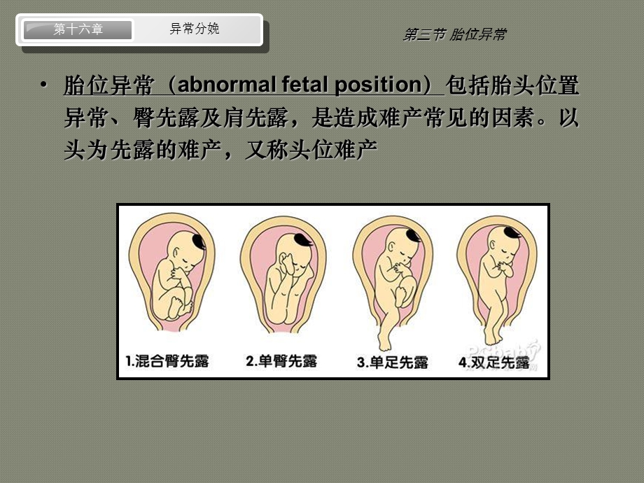 第八版妇产科配套ppt课件 异常分娩 胎位异常.ppt_第2页
