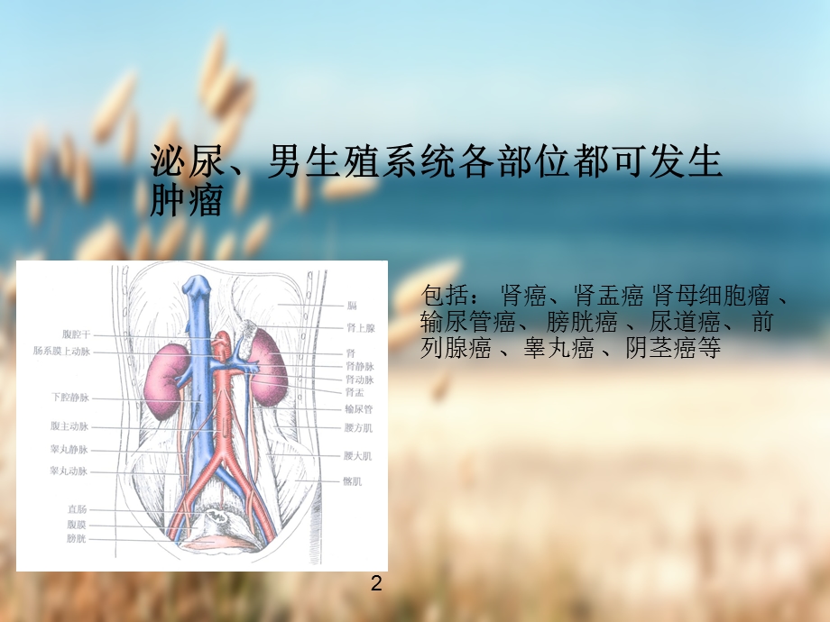 前列腺癌查房课件.ppt_第2页