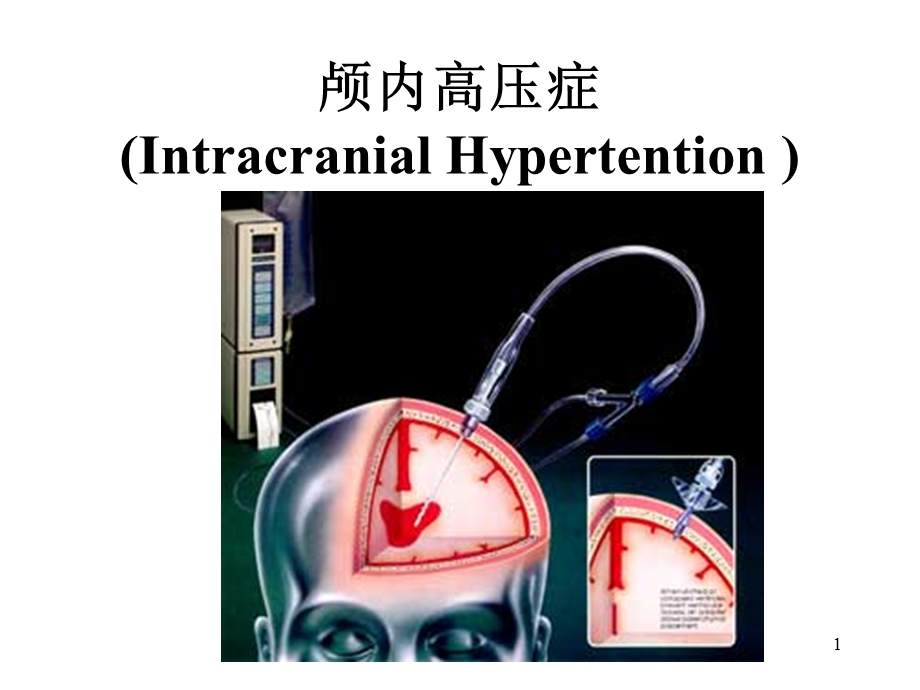 颅内高压症课件.ppt_第1页