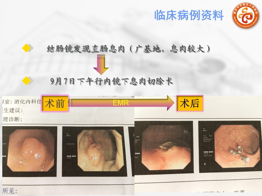 病例回顾分析【消化内科】课件.ppt_第3页