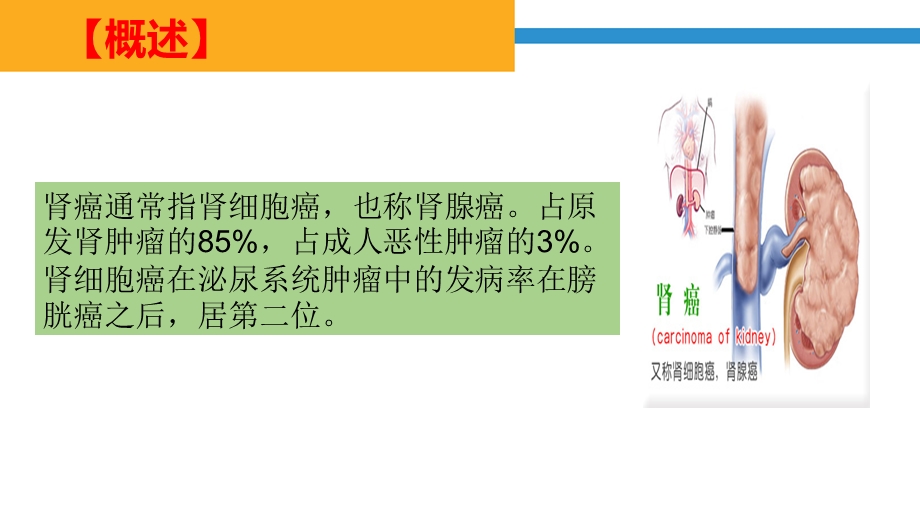 肾癌病人的医疗护理培训ppt课件.ppt_第2页