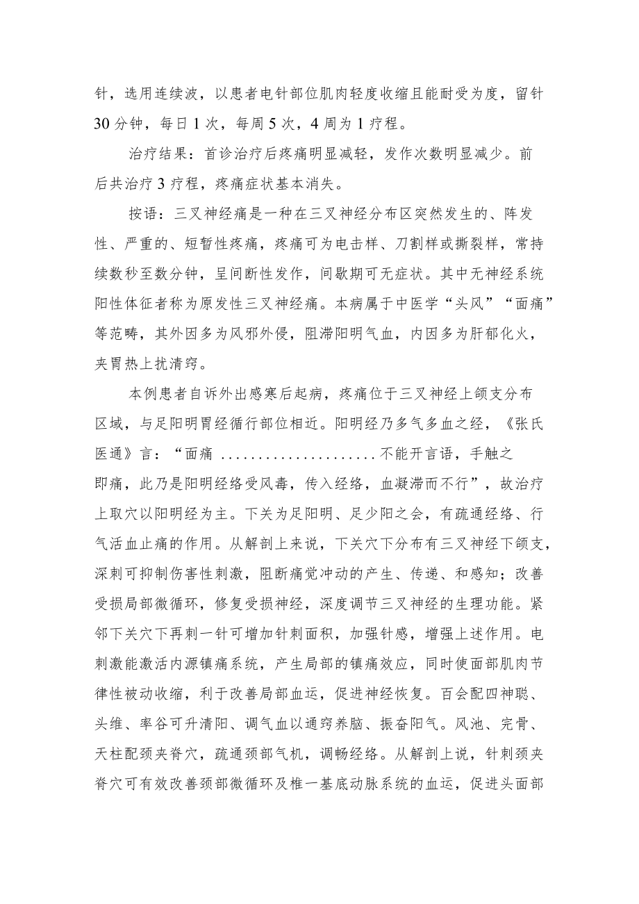 中医针灸治疗三叉神经痛病例分析专题报告1.docx_第2页