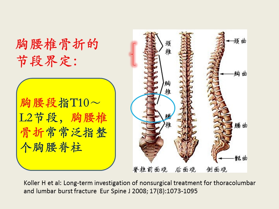 胸腰椎骨折的分型与临床意义课件.ppt_第2页