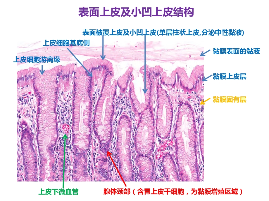 胃早癌经典ppt课件.ppt_第3页