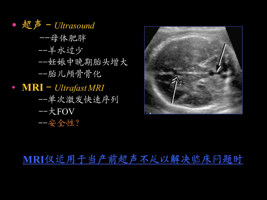 胎儿磁共振成像MR Imaging of the Fetu课件.ppt_第2页