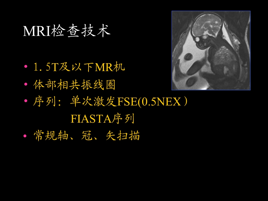 胎儿磁共振成像MR Imaging of the Fetu课件.ppt_第3页