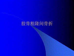 股骨粗隆间骨折课件.ppt