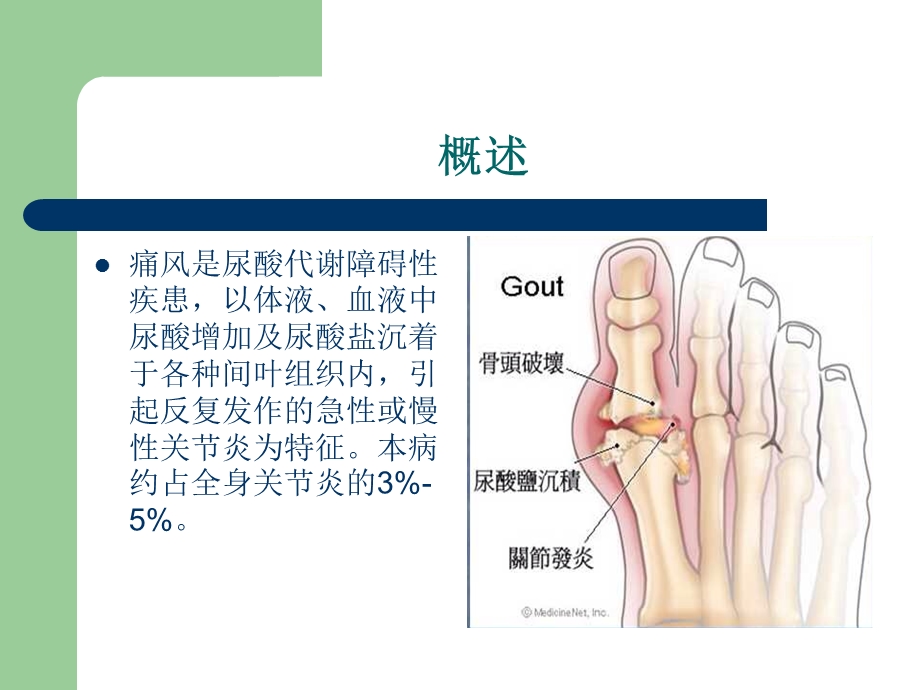 痛风专业知识宣讲讲义课件.ppt_第2页