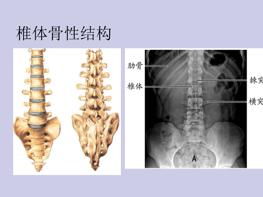 腰椎的临床解剖课件.ppt_第2页