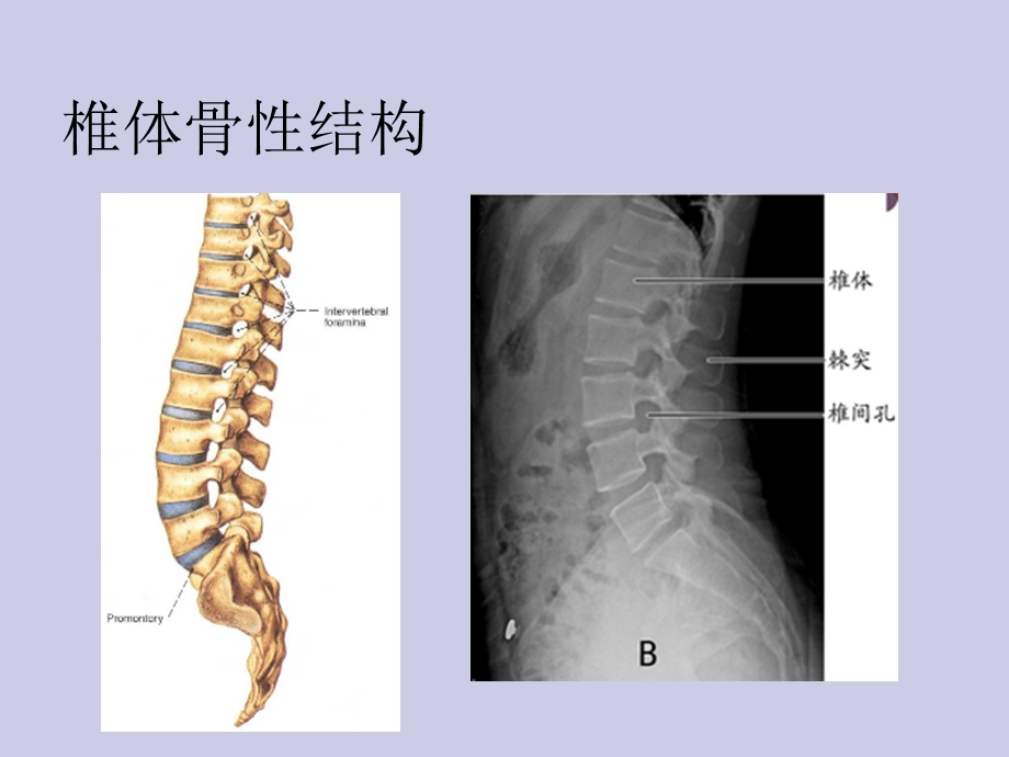 腰椎的临床解剖课件.ppt_第3页