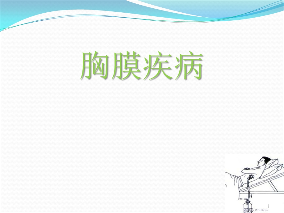 胸膜疾病 课件.ppt_第1页