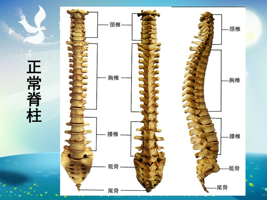 脊柱侧弯围手术期护理ppt课件.ppt_第2页