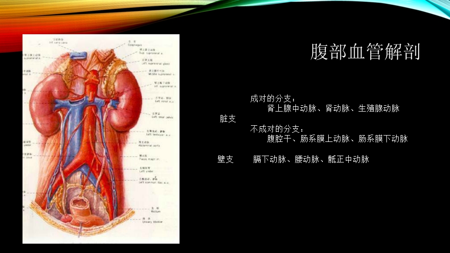 腹部大血管疾病的超声诊断课件.ppt_第2页