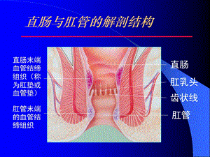 痔的套扎治疗课件.ppt