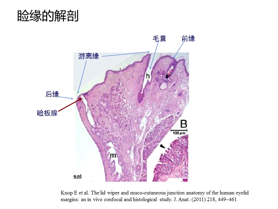 睑缘解剖与睑缘炎病理机理课件.ppt_第1页