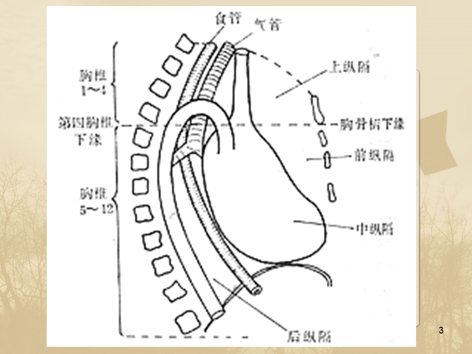 纵隔病变课件.ppt_第3页