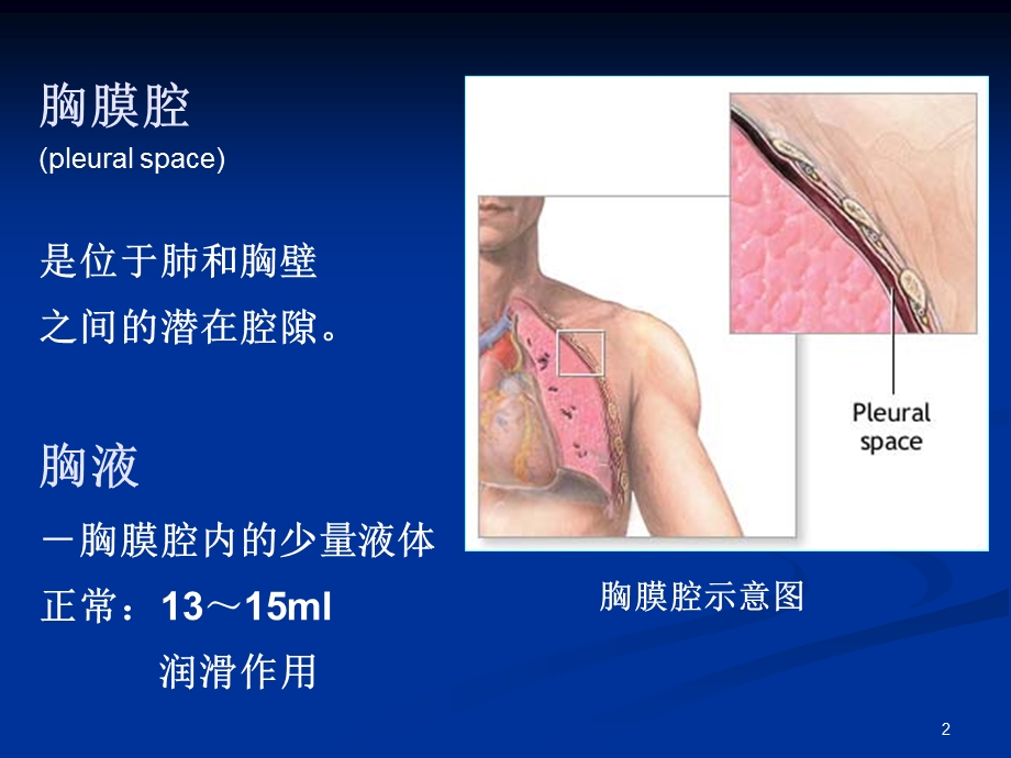 胸腔积液诊治及护理课件.ppt_第2页