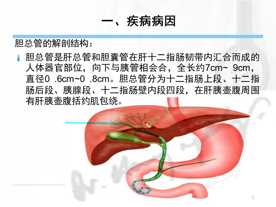 胆总管结石系统回顾课件.ppt_第3页