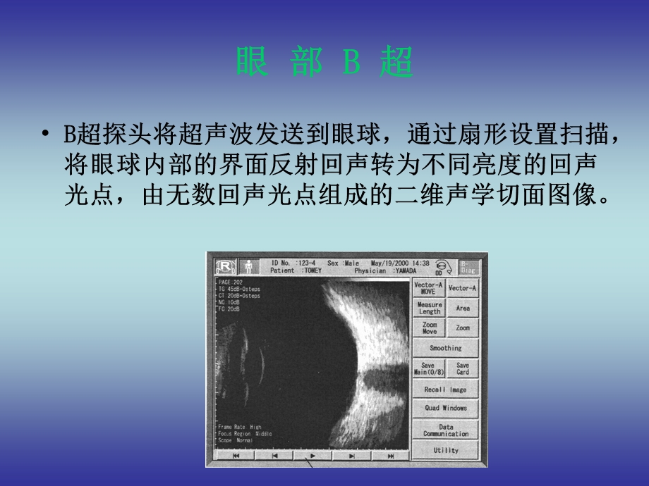 眼部超声诊断课件.ppt_第2页