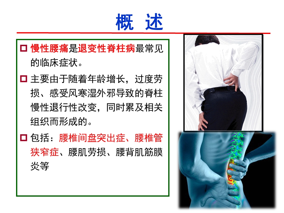 腰腿痛中医康复治疗课件.ppt_第2页