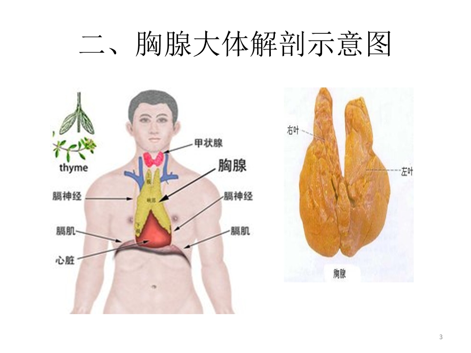 胸腺瘤影像表现(教学ppt课件).ppt_第3页