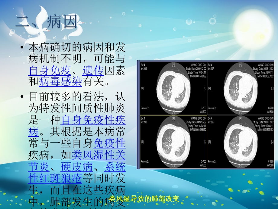 特发性间质性肺炎的护理ppt课件.ppt_第2页