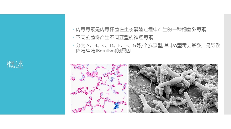 肉毒素的神经内科临床应用课件.ppt_第2页