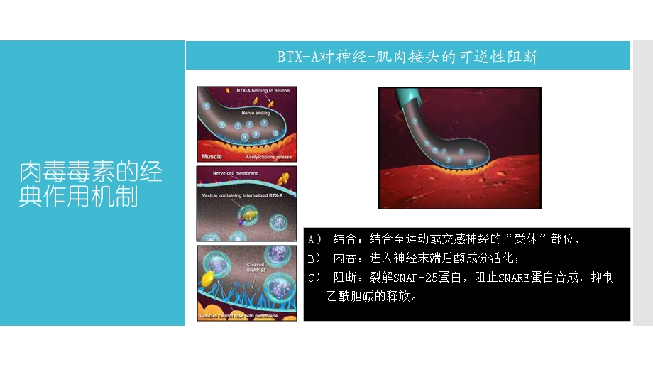 肉毒素的神经内科临床应用课件.ppt_第3页