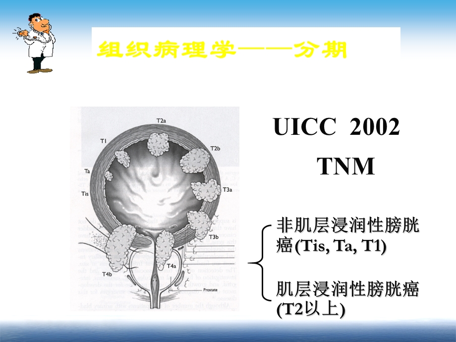 膀胱癌化疗课件.ppt_第3页