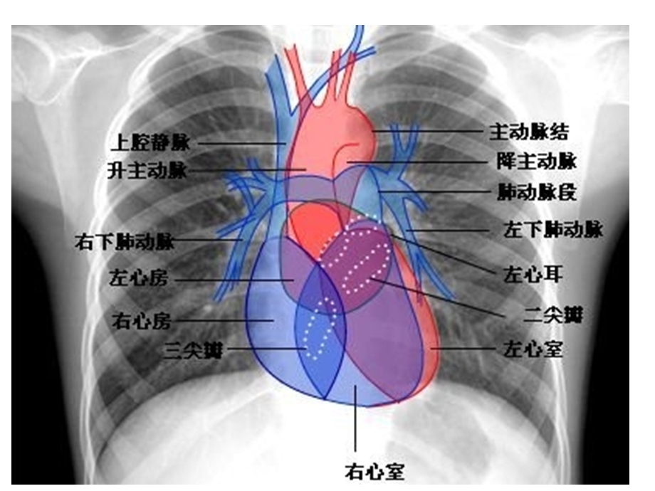 胸部CT影像示意图培训ppt课件.ppt_第2页