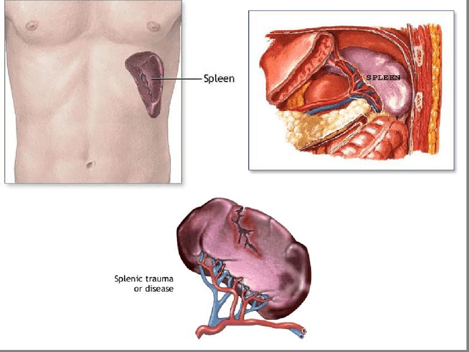 脾破裂及急救最新课件.ppt_第3页
