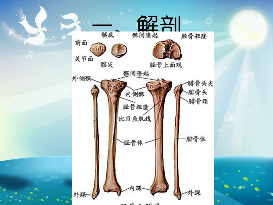 胫腓骨骨折内固定术手术配合ppt课件.ppt_第3页