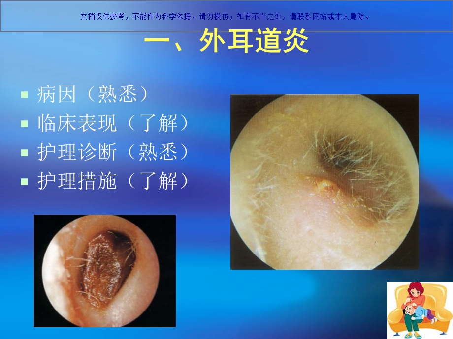 耳部常见疾病医疗护理常规ppt课件.ppt_第2页