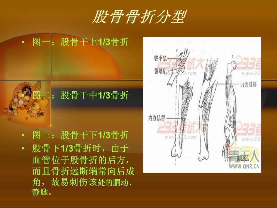 股骨干骨折护理查房课件.ppt_第3页